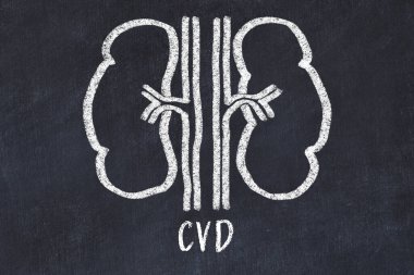 İnsan böbreklerinin tebeşir çizimi ve tıbbi terim CVD. Tıp öğrenme kavramı.