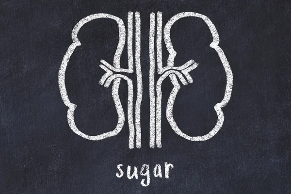 Dibujo Tiza Riñones Humanos Término Médico Azúcar Concepto Aprender Medicina — Foto de Stock