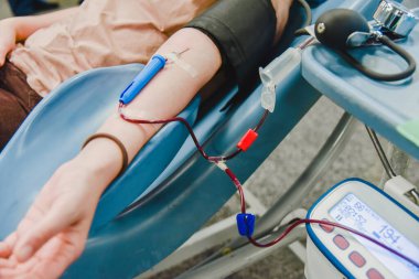 Kan bağışı sırasında elinde iğne ve kan toplama cihazı olan bir insan kolu. Klinikte kan nakli. Gönüllü fedakarlık için Phlebotomy. Kan bağışı merkezinde kanepeye uzanmış bir kadın..