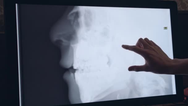 Doctor mano apuntando fotos de rayos X de cráneo — Vídeos de Stock