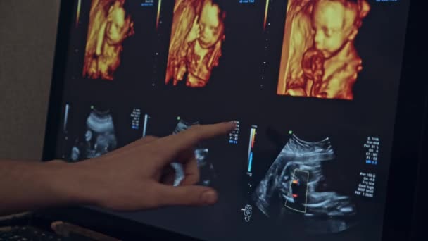 超音波モニター画面は、母親の子宮の赤ちゃんを示しています — ストック動画