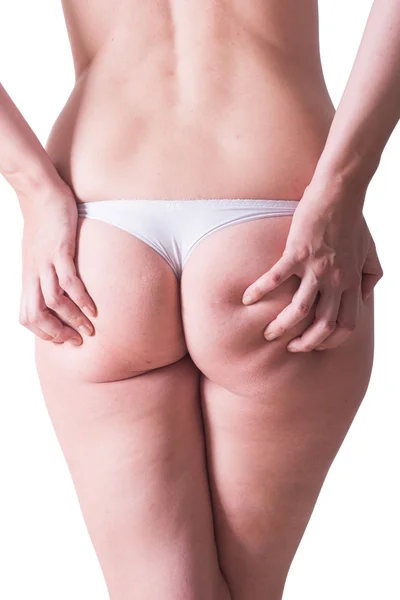 Femme en culotte blanche avec de la cellulite sur son cul — Photo