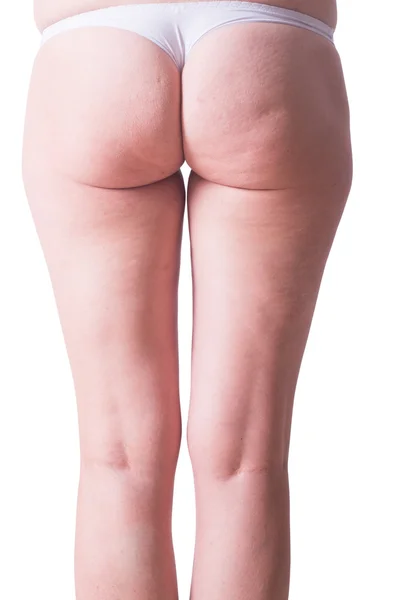 Kadın bacaklarının selülit ile beyaz külot