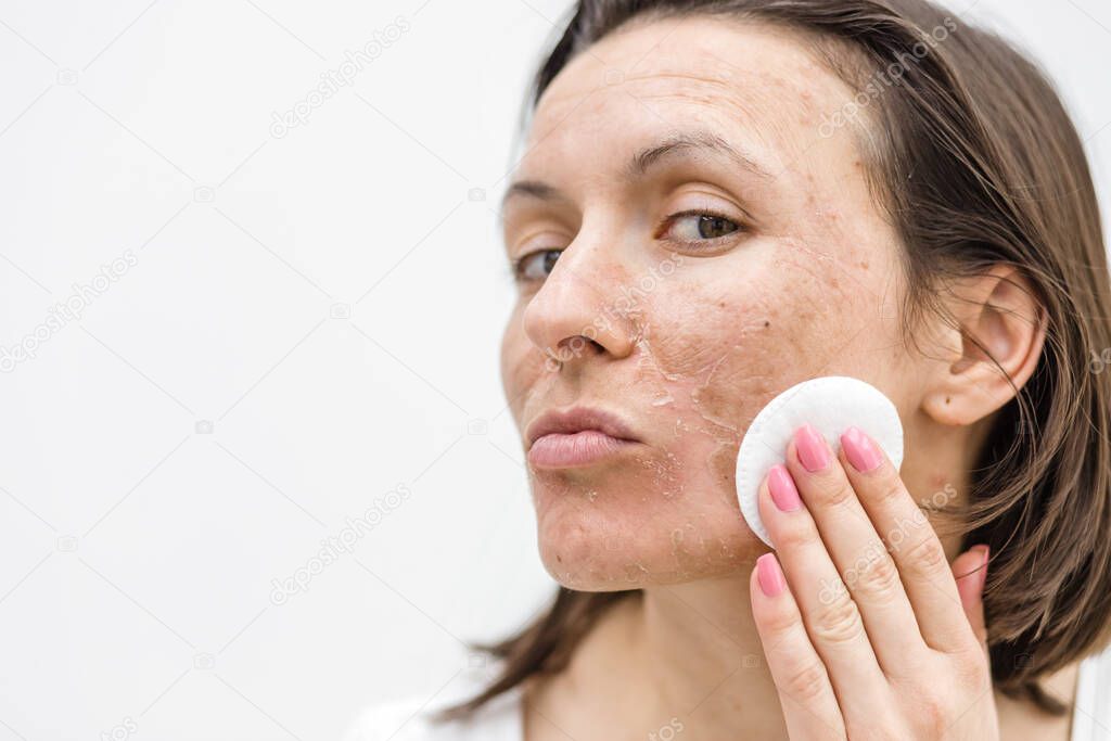 Close up photo of woman cleaning face with cosmetic sponge.