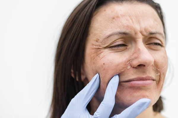 Close up photo of female face and hand in medical glove. — Stock Photo, Image