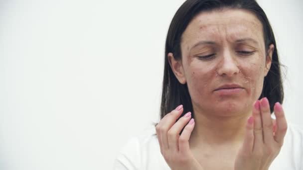 Vidéo 4k de gros plan visage féminin avec des problèmes de peau. — Video