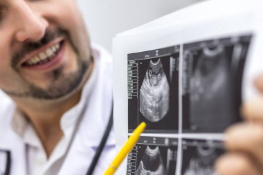Ultrason sonuçlarına bakan bir erkek doktorun kesilmiş fotoğrafı..