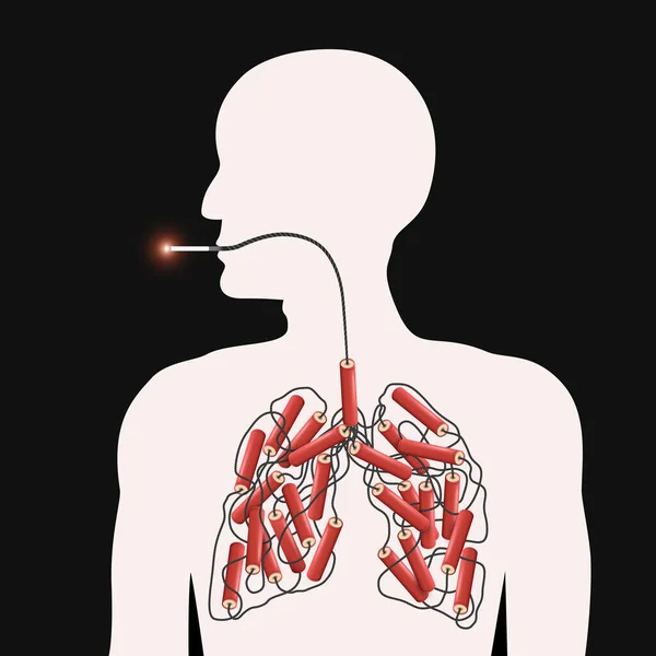 Rauch Tötet Plakat Metaphorische Darstellung Der Gefahren Des Rauchens Angezündete — Stockvektor