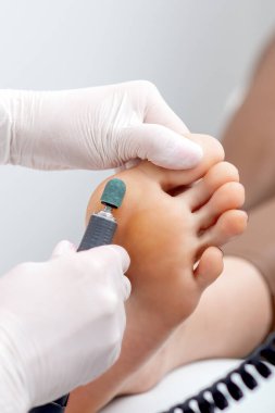Güzellik salonunda beyaz eldivenli ayak hastalıkları uzmanının elleri sayesinde ayak pedikürü ameliyatından yaya olarak sıyrılmak.