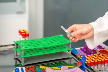 Kadın doktorun elleri laboratuarda kan örnekleme için gerekli aletleri hazırlıyor.