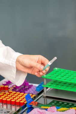 Kadın doktorun elleri laboratuarda kan örnekleme için gerekli aletleri hazırlıyor.
