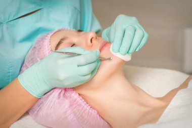 Yüz temizleme. Blackhead Silme Aracı. Güzellik uzmanı güzellik salonunda kadın çenesindeki siyah noktayı ve sivilceyi çıkarıyor.