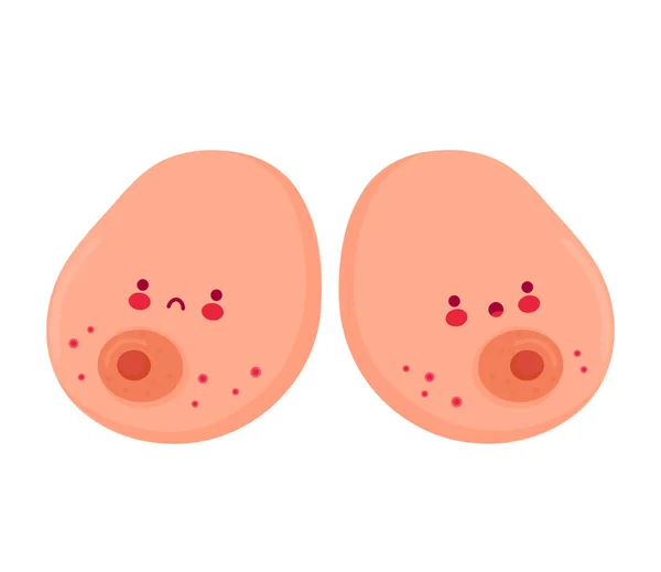 Carino seno donna divertente con eruzione cutanea rossa — Vettoriale Stock