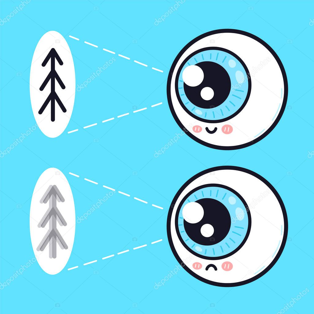 Cute sad and happy human eyeball organ look on tree character. Vector doodle cartoon illustration icon design. Eye care, bad,good vision,eyeball problem character concept