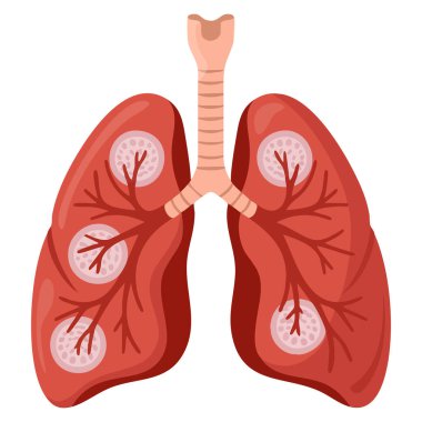 Beyaz arka plan solunum hastalıkları üzerine akciğer kanseri yassı tasarımı poster afişi sunumu ve sağlık farkındalığı tasarımları için uygun tıbbi illüstrasyon