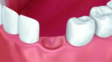 Diş bakımı konseptleri için yüksek kaliteli yakın çekim ve diş eti.