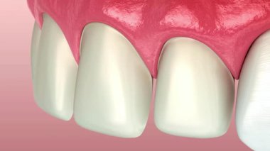 Pembe diş etlerine sahip sağlıklı beyaz dişlerin detaylı biçimde yakın plan çekimleri, ağız sağlığı ve sağlık durumu iletiliyor.