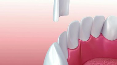 Tıbbi ve sağlık hizmetleri için diş implantlarının yüksek kalitede çizimi ve sağlıklı diş etleri