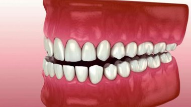 Sağlıklı insan dişleri ve diş etlerinin detaylı üç boyutlu çizimi, diş ve tıbbi içerik için mükemmel.