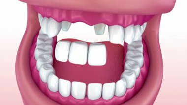 Diş sağlığı eğitimi ve tıbbi pazarlama için insan dişlerinin ve diş etlerinin yüksek kaliteli 3D çizimi, bilgilendirici ve ticari kullanım için ayrıntılı anatomi sergileniyor