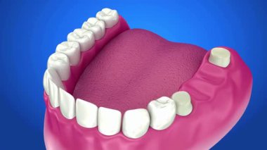 Mavi arka planda pembe sakız ve beyaz dişler sergilenen yüksek kalite diş modeli, eğitim ve tıbbi amaçlar için ideal.