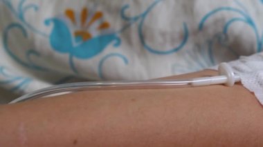 Damardan damar terapisi enjeksiyon, tıbbi tedavi