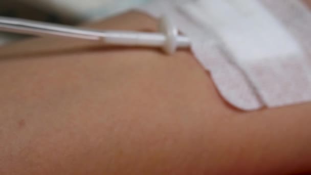 Suntikan jarum dalam penyakit arteri tangan perempuan — Stok Video