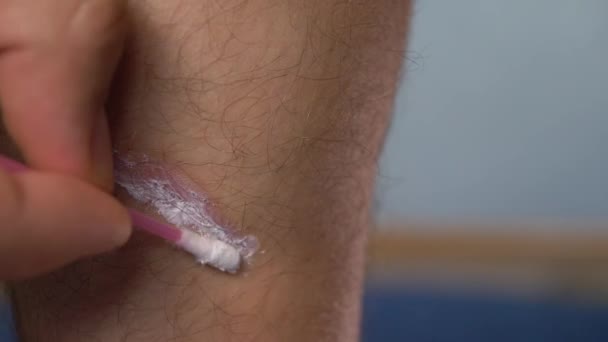 Mano aplicar crema sobre la herida en la piel en la pierna del músculo de la pantorrilla — Vídeos de Stock