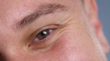 Mans eyes, çevresindeki kahverengi alan ise iris.