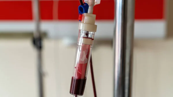 Ankara Turquía Marzo 2021 Sérum Transfusión Sangre Habitación Del Hospital — Foto de Stock