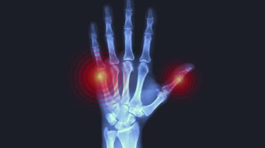 El kemiğinin 3 boyutlu tıbbi çizimi