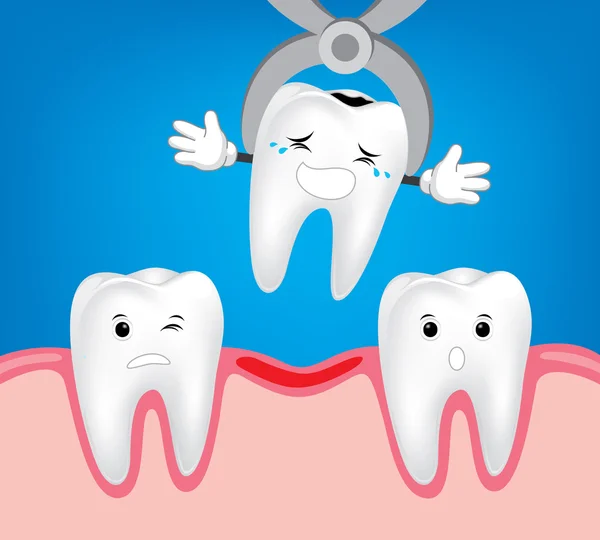 Zubní extrakce zubu — Stockový vektor
