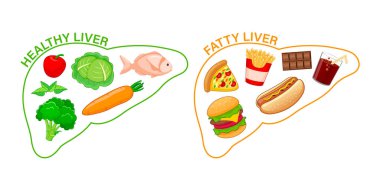 İnsan karaciğeri şeklinde sağlıklı ve sağlıksız yiyecekler. Yağlı karaciğer farkındalığı. Vektör illüstrasyonu.