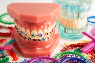 Ortodontik bağlar halkalar ve kravatlar, diş hekimliği üzerine çalışan dişçi için model..