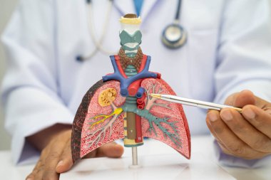 Zatürree, akciğer kanseri, Asyalı doktor hastanede teşhis ve tedavi için insan anatomisi modeli tutuyor.
