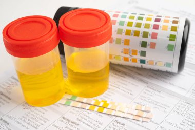 İdrar tahlili, reaksiyonlu idrar kabı. PH kağıt testi ve karşılaştırma tablosu laboratuvarda..