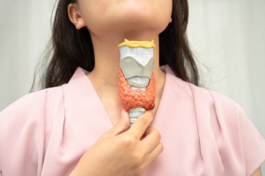 Hipertiroidizm, aşırı aktif tiroid, tiroid lenfoma, tiroid bezi insan anatomisi olan Asyalı kadın..