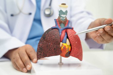Zatürree, akciğer kanseri, Asyalı doktor hastanede teşhis ve tedavi için insan anatomisi modeli tutuyor.