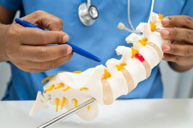 Omurga ve kemik modeli taşıyan Asyalı doktor, ortopedi bölümünde tedavi için bel kemiği yerinden oynamış disk parçası..