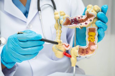 Bağırsak, hastanede teşhis ve tedavi için insan anatomisi modeli tutan doktor..