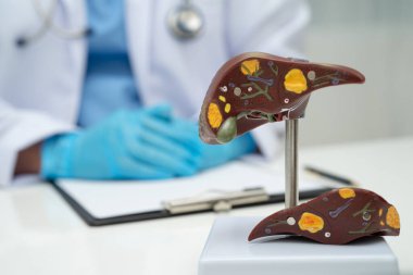 Dünya Hepatit Günü 'nde siroz, karaciğer kanseri, yağlı karaciğer, karaciğer anatomisi olan Asyalı doktor..