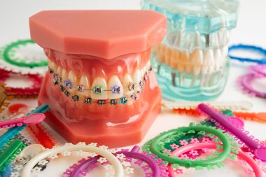 Ortodontik bağlar halkalar ve kravatlar, diş hekimliği üzerine çalışan dişçi için model..