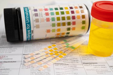 İdrar tahlili, reaksiyonlu idrar kabı. PH kağıt testi ve karşılaştırma tablosu laboratuvarda..