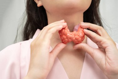 Hipertiroidizm, aşırı aktif tiroid, tiroid lenfoma, tiroid bezi insan anatomisi olan Asyalı kadın..