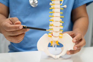 Omurga ve kemik modeli taşıyan Asyalı doktor, ortopedi bölümünde tedavi için bel kemiği yerinden oynamış disk parçası..