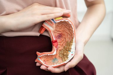 Mide hastalığı, Asyalı bir kadın hastanede teşhis ve tedavi için anatomi modeli tutuyor..