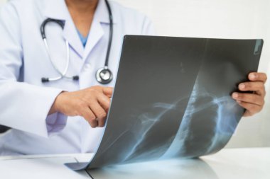 Doktor akciğer röntgen filmini inceliyor..