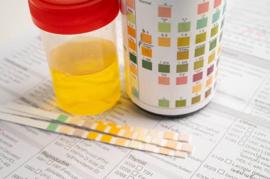 İdrar tahlili, reaksiyonlu idrar kabı. PH kağıt testi ve karşılaştırma tablosu laboratuvarda..