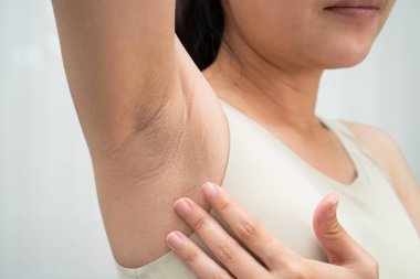 Asyalı kadınların siyah koltuk altı güzellik sorunları vardır..