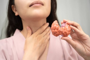 Hipertiroidizm, aşırı aktif tiroid, tiroid lenfoma, tiroid bezi insan anatomisi olan Asyalı kadın..